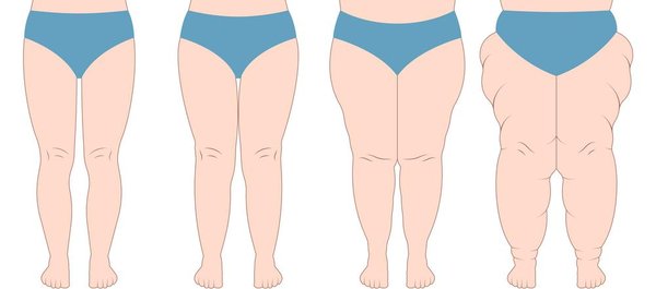 ilustração mostrando diferentes corpos femininos