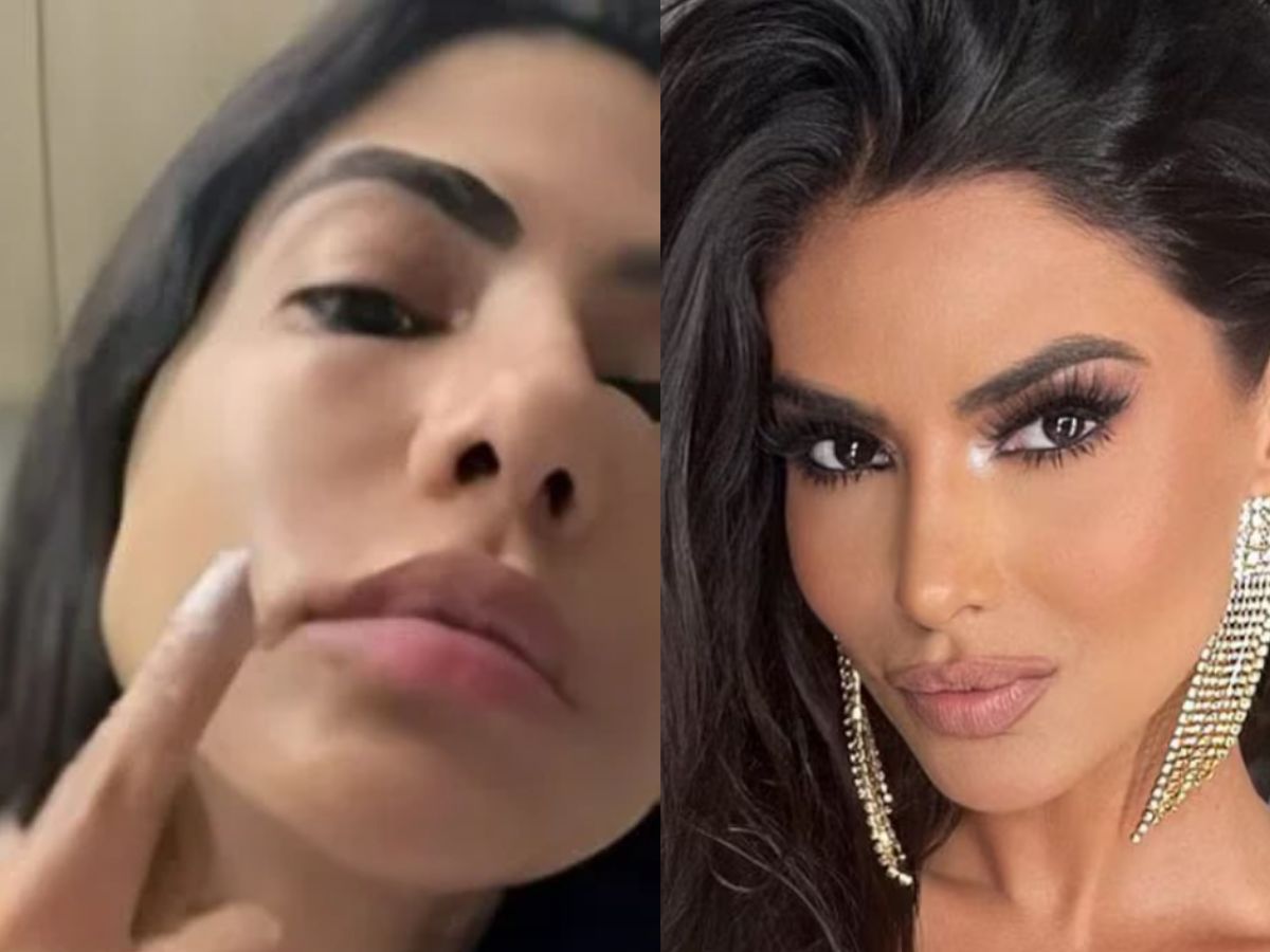 Anvisa mantém uso do PMMA no Brasil após CFM pedir suspensão: Flavia Noronha problemas com PMMA