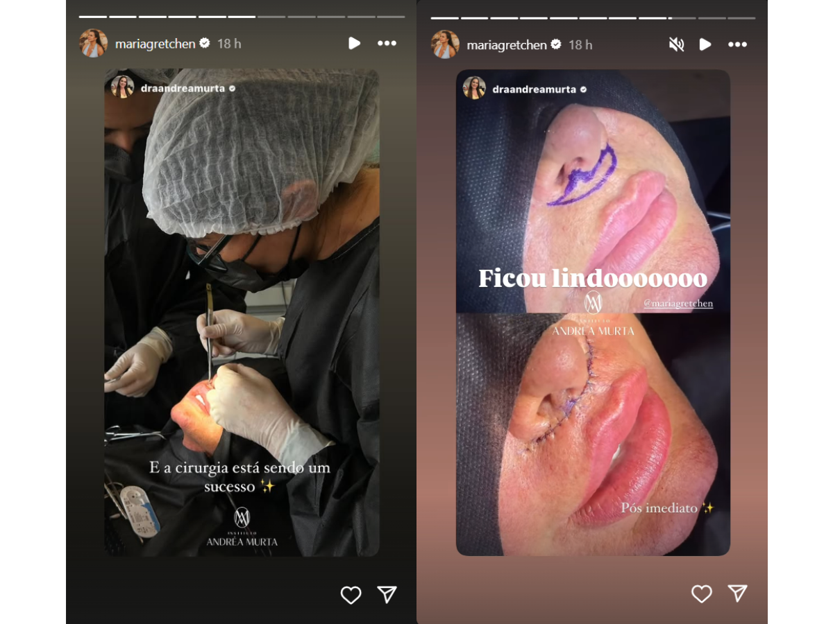 Reprodução Instagram/montagem Reprodução Instagram/montagem