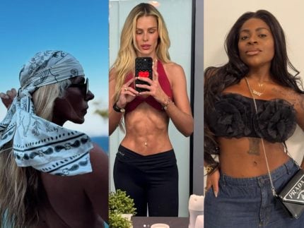 Sem filtro: conheça as famosas que enfrentaram a pressão estética e s