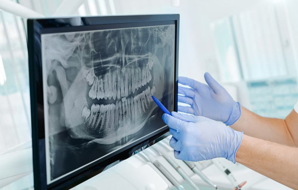 Radiografia de uma arcada dentária