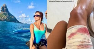 Advogada é mordida por tubarão durante mergulho em Fernando de Noronha