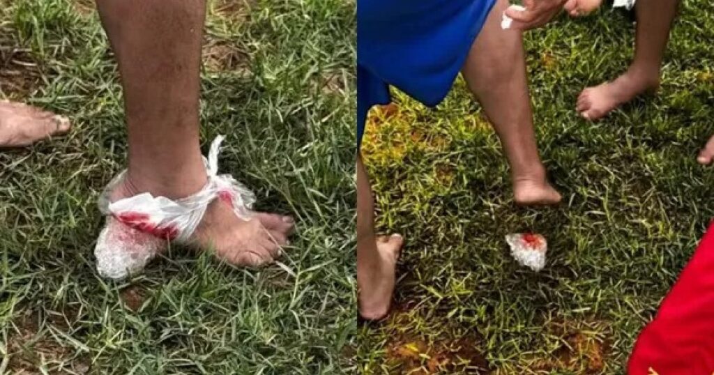 Ataque de piranhas deixa feridos em Iaçu e prefeitura deve interditar trecho do Rio Paraguaçu