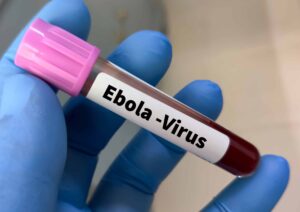 Exame descarta ebola em paciente internado em São Paulo