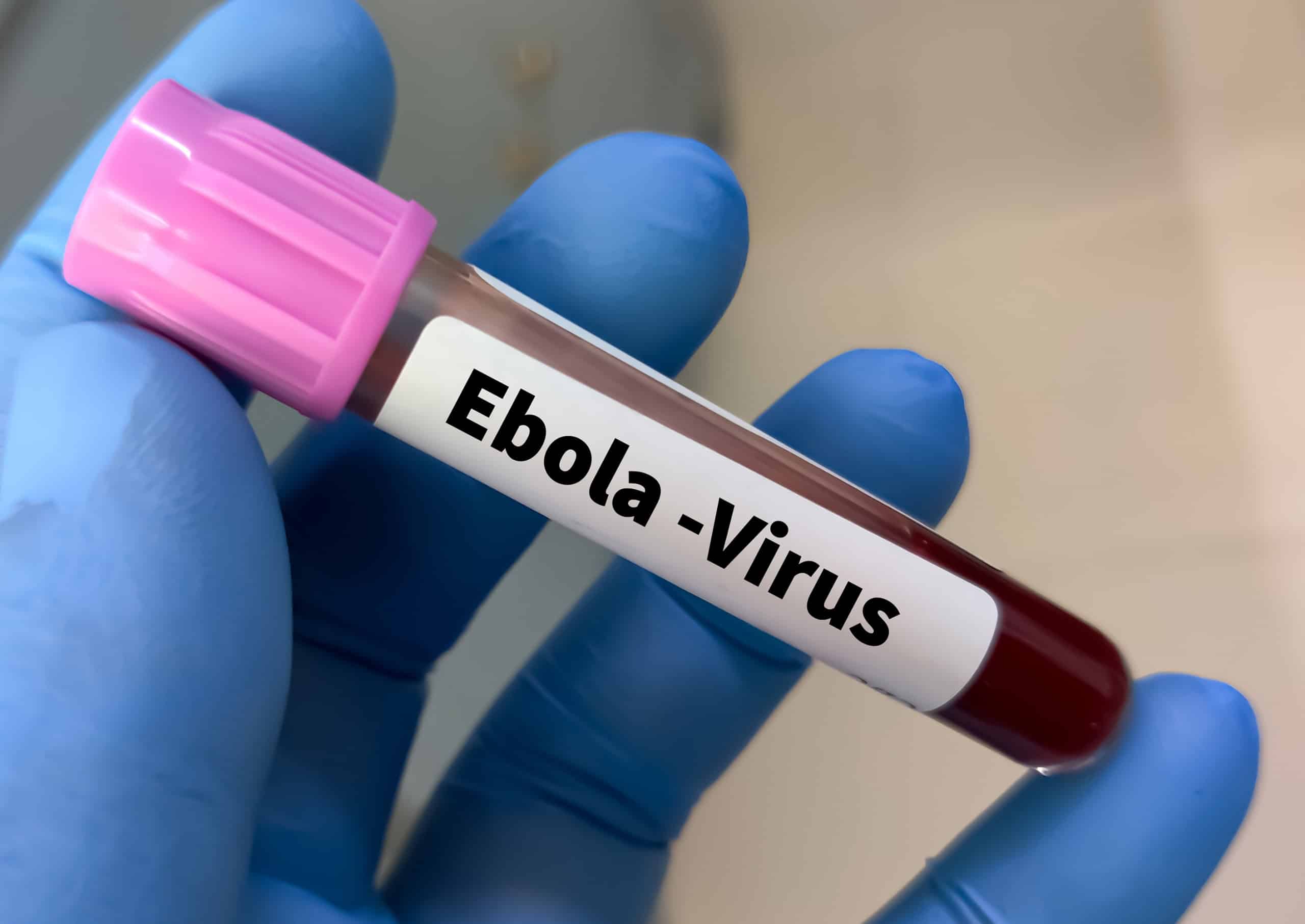 Exame descarta ebola em paciente internado em São Paulo