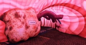 Evento gratuito em Salvador traz estômago gigante inflável para alertar sobre H. pylori e câncer gástrico