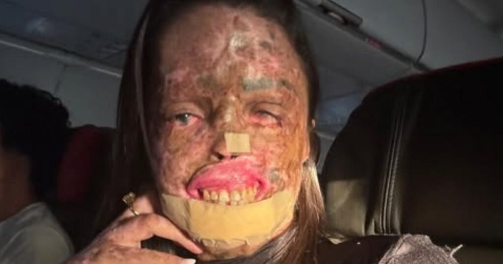 Influenciadora Káh Felipe morre aos 33 anos após batalha contra com câncer causado por doença rara