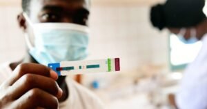 ONU alerta que cortes de recursos podem provocar nova alta de casos de HIV