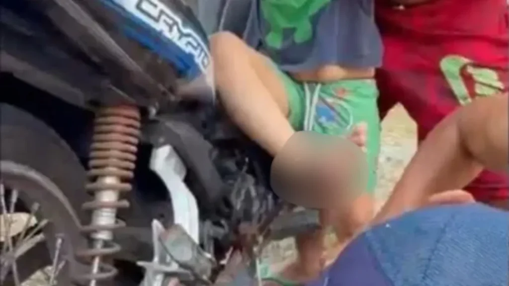 Criança de quatro anos sofre acidente com pedal de moto em Rio Preto da Eva