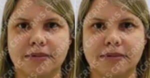 Médica investigada por falsificação de diplomas é solta após dez dias de prisão