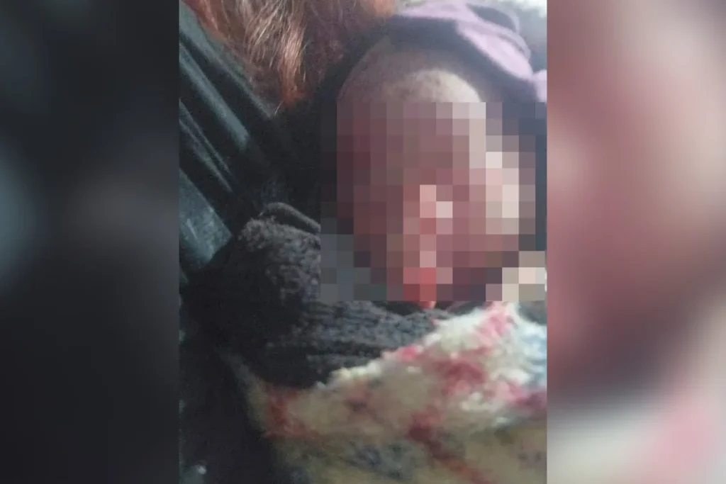 Recém-nascida é encontrada abandonada dentro de saco de lixo no Paraná