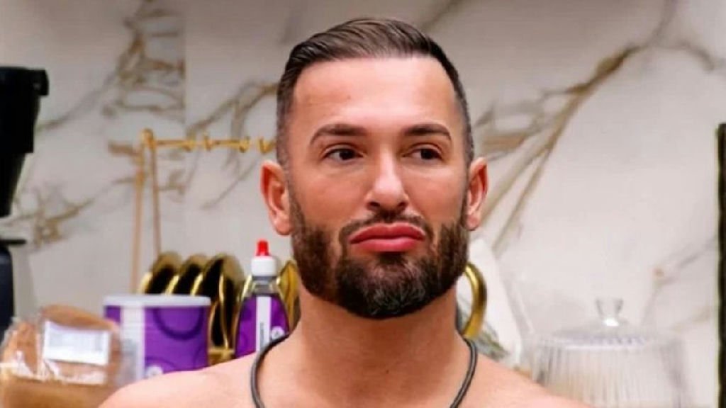 Diego Hypolito surpreende seguidores ao revelar transformação facial com procedimentos