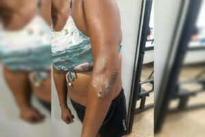 Homem é preso após arremessar pedras contra a sogra em Formosa