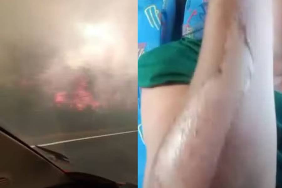 Incêndio na Ba-160 deixa 19 feridos após ônibus com pacientes ser atingido por chamas