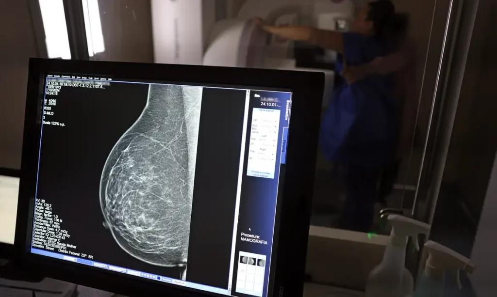 Planos de saúde passam a cobrir mamografia digital sem limite de idade