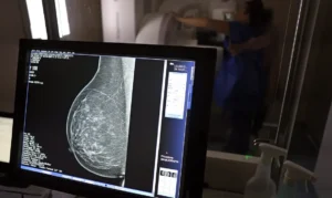 Planos de saúde passam a cobrir mamografia digital sem limite de idade