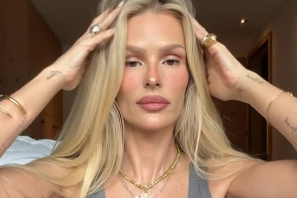 Yasmin Brunet expõe marcas de lipedema e detalha rotina de dores e inflamação