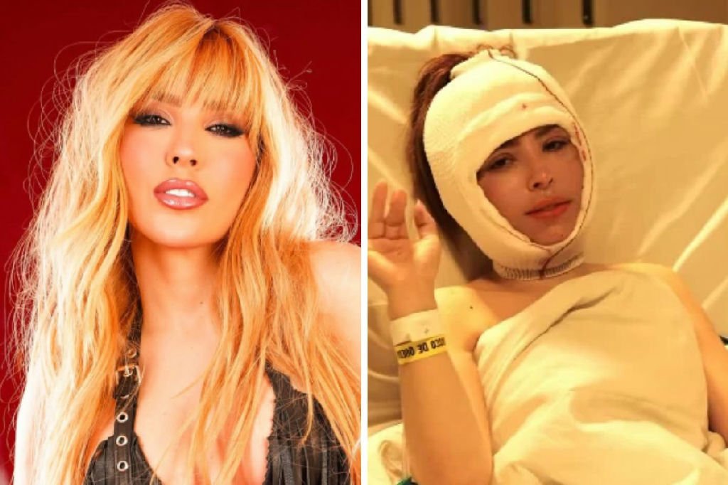 Cantora Manu Bahtidão mostra resultado de cirurgia plástica no rosto