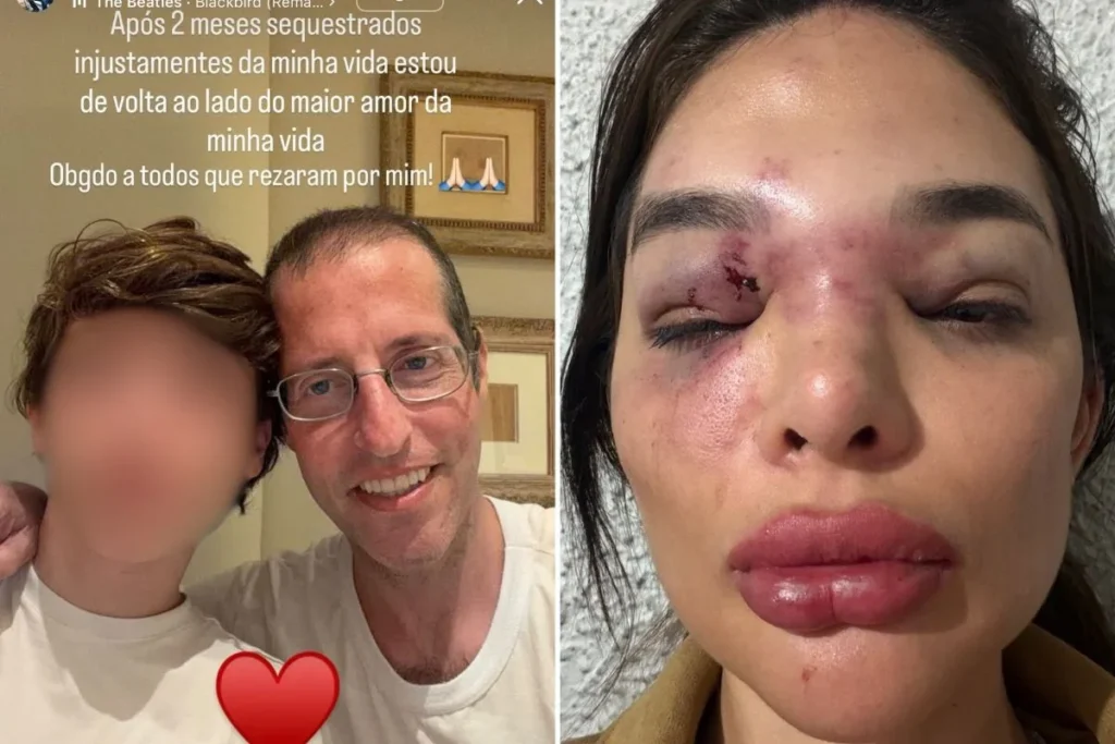 Ivo Kos celebra liberdade após dois meses preso por agredir esposa