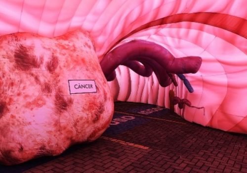 Evento gratuito em Salvador traz estômago gigante inflável para alertar sobre H. pylori e câncer gástrico