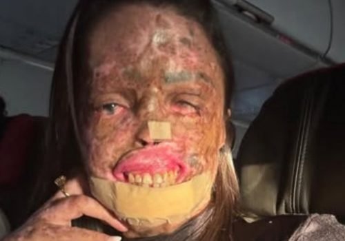 Influenciadora Káh Felipe morre aos 33 anos após batalha contra com câncer causado por doença rara