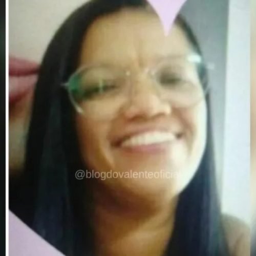 Mulher vítima de ataque com ácido em SAJ morre após 17 dias internada em Salvador