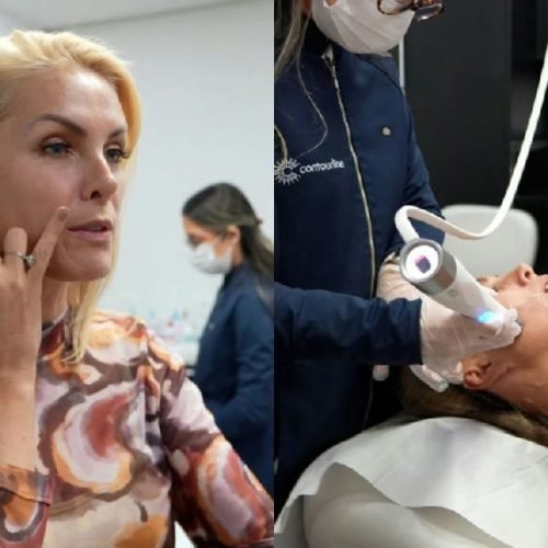 Ana Hickmann realiza procedimento estético antes de oficializar união com Edu Guedes