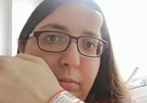 Caroço na testa levou a mulher a descobrir mieloma e perfuração no crânio