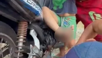 Criança de quatro anos sofre acidente com pedal de moto em Rio Preto da Eva