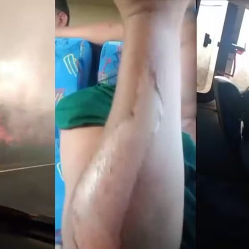 Incêndio em rodovia baiana deixa 19 feridos após ônibus atravessar chamas