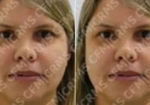 Médica investigada por falsificação de diplomas é solta após dez dias de prisão
